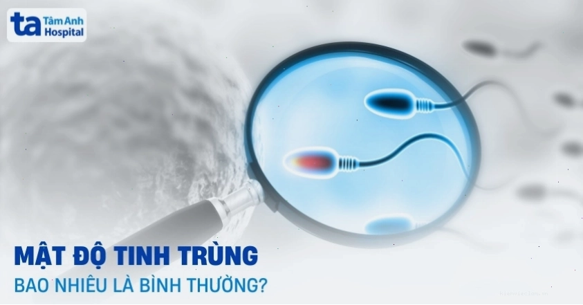Mật độ tinh trùng là gì? Bao nhiêu là bình thường? Ý nghĩa ra sao?