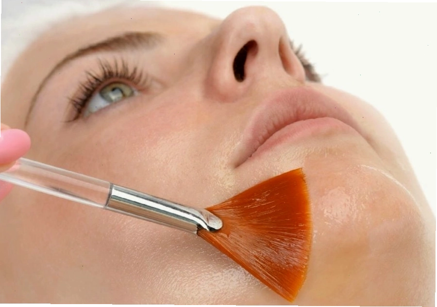 Mẫu người dùng đang chống nắng kỹ càng sau peel