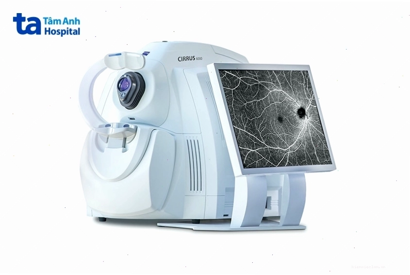 Máy chụp OCT hiện đại tại bệnh viện