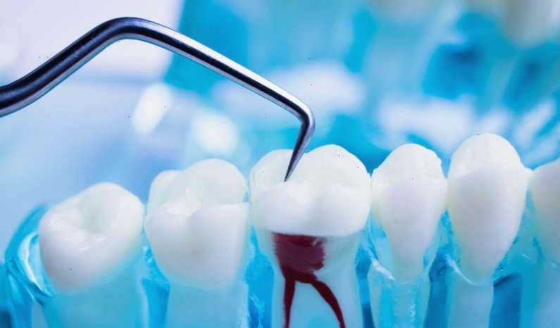 Nhiều nguyên nhân có thể dẫn đến tình trạng răng bị lung lay