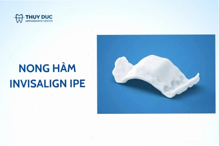 Nong hàm Invisalign IPE