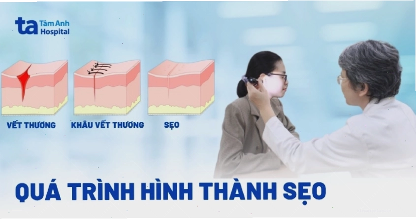 Quá trình hình thành sẹo trên da