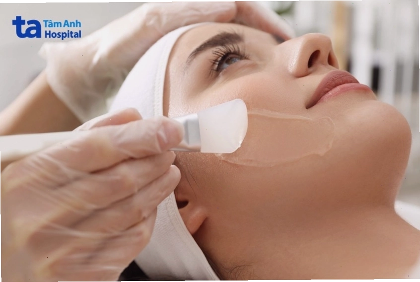 Quy trình chăm sóc da sau khi sử dụng TCA