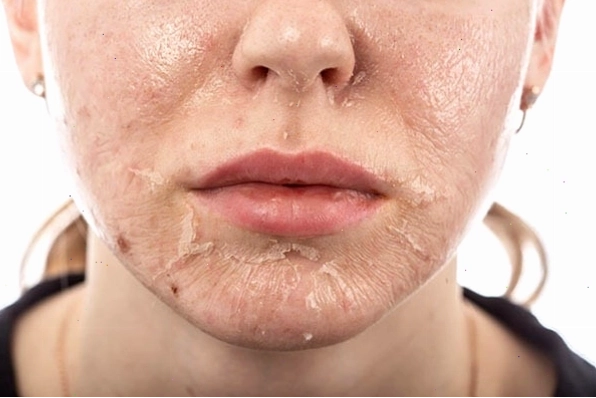 Quy trình peel da mặt tại spa chuyên nghiệp