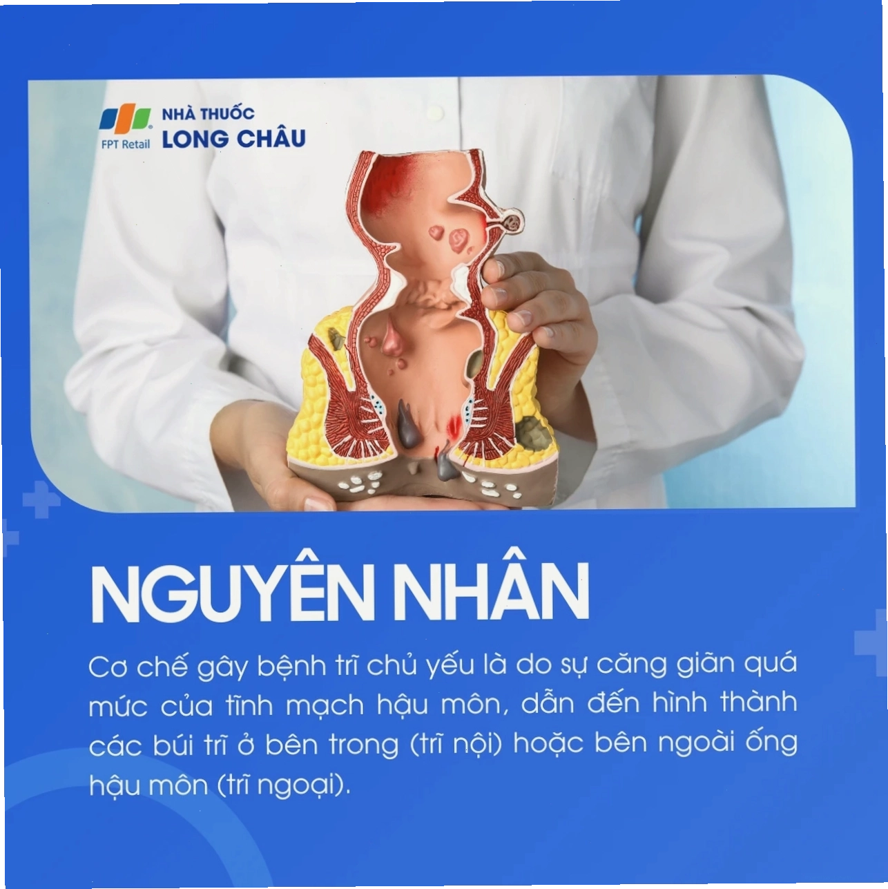 Quy trình phẫu thuật cắt trĩ