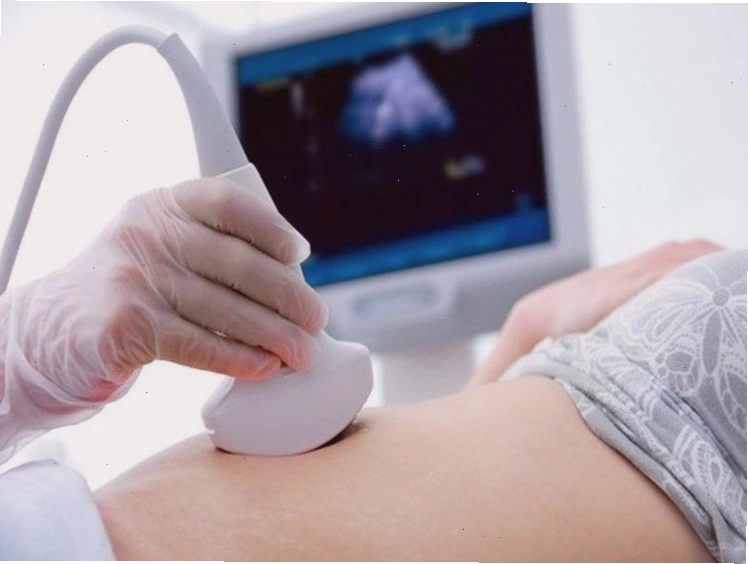 Siêu âm thai giúp xác định tuổi thai chính xác