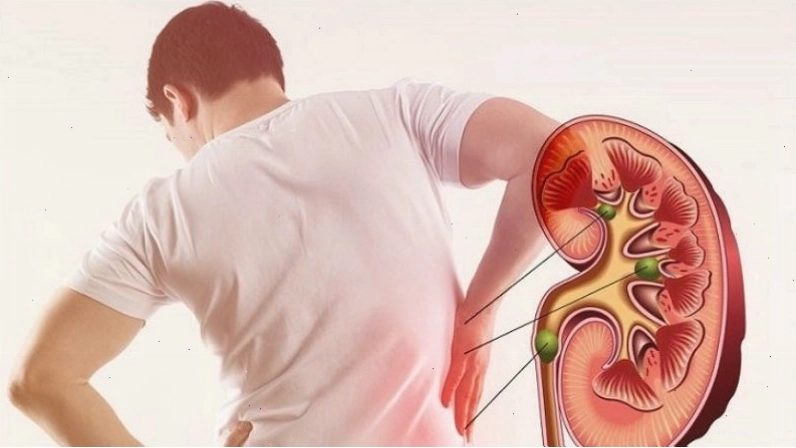 Tác hại của rượu bia đến thận