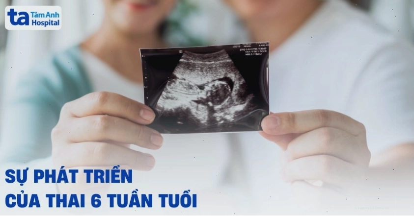 Thai nhi 6 tuần tuổi với các cấu trúc cơ bản đang hình thành