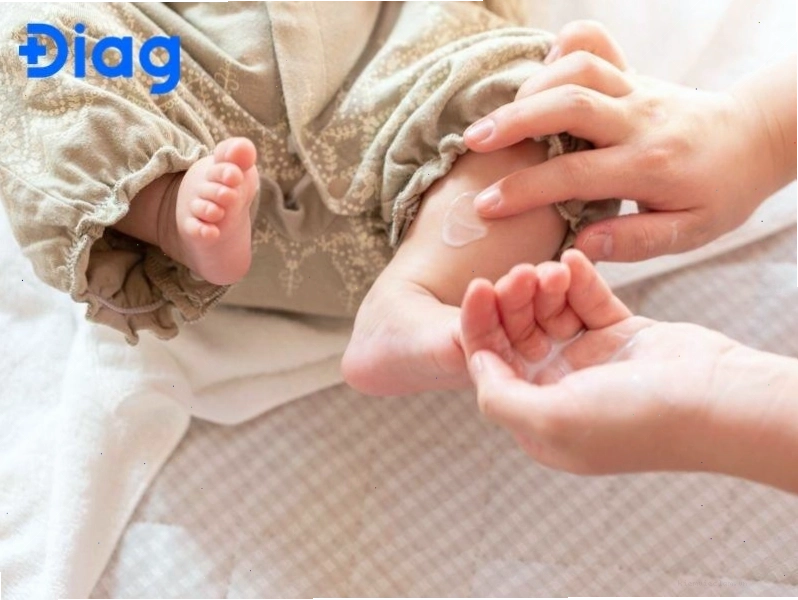 Thoa kem dưỡng ẩm hoặc thuốc mỡ làm dịu da giúp duy trì độ ẩm và phục hồi hàng rào bảo vệ da của trẻ.