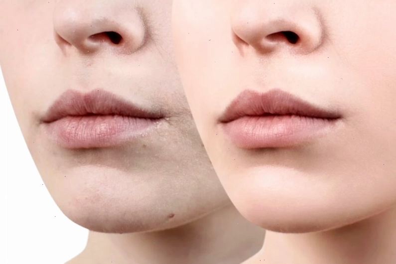 Thoa mật ong nguyên chất lên môi giúp dưỡng ẩm và làm sáng da