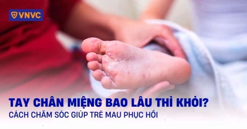 Thời gian phục hồi của bệnh tay chân miệng