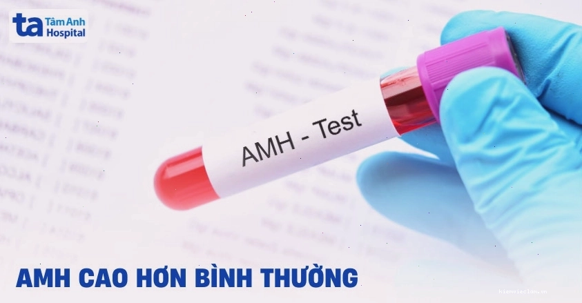Tìm hiểu về chỉ số AMH cao và ý nghĩa của nó