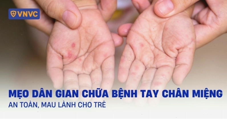 Trẻ bị bệnh chân tay miệng với các nốt đỏ đặc trưng trên tay và chân