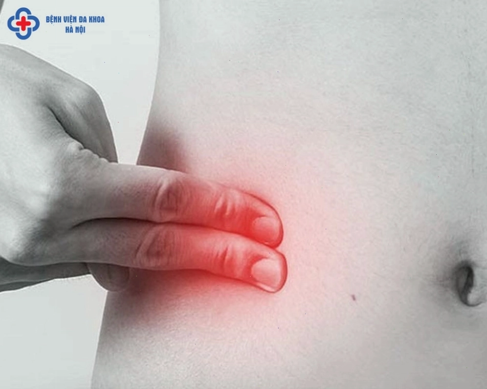 Vị trí đau ruột thừa là ở bụng dưới bên phải