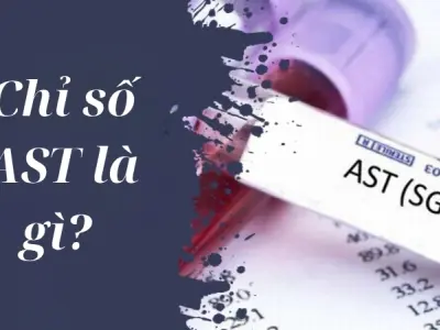 AST là chỉ số gì và cảnh báo gì về sức khỏe gan của bạn