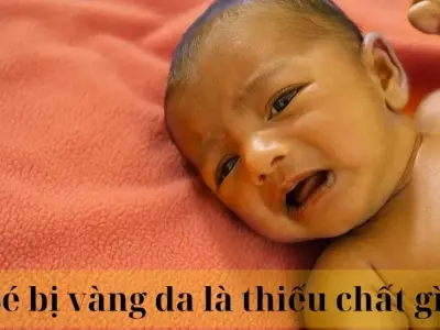 Bé bị vàng da là thiếu chất gì và có nguy hiểm không?