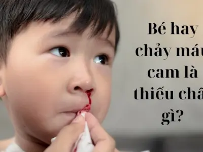 Bé hay chảy máu cam là thiếu chất gì cha mẹ cần biết