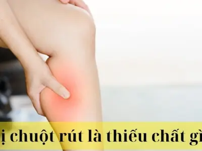 Bị chuột rút là thiếu chất gì và cách phòng ngừa hiệu quả