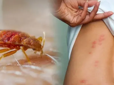 Bị gián cắn có sao không và triệu chứng cảnh báo nguy hiểm