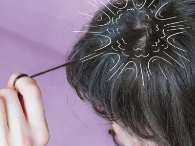Bị giật tóc có sao không và dấu hiệu cần đi khám sớm