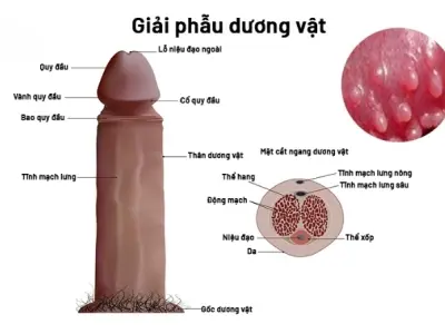Bị hạt ngọc có sao không và cách xử lý hiệu quả