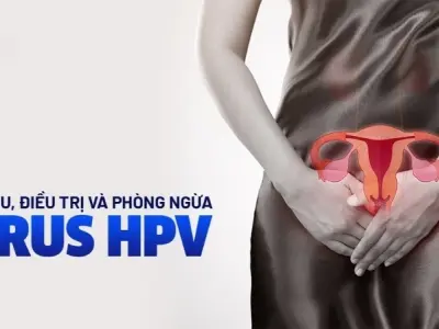 Bị HPV có sao không? Giải đáp nguy cơ và biến chứng