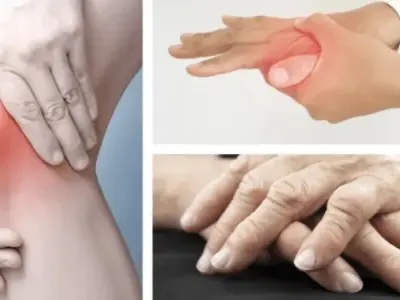 Bị phong thấp có sao không và cách điều trị hiệu quả