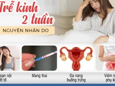 Bị trễ kinh 2 tuần có sao không và khi nào cần lo lắng