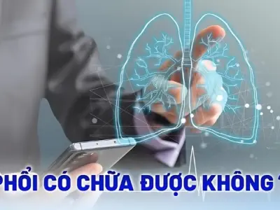 Bị xơ phổi có sao không và cách nhận biết sớm bệnh lý