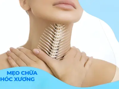 Cách chữa mẹo hóc xương nhanh gọn hiệu quả tại nhà