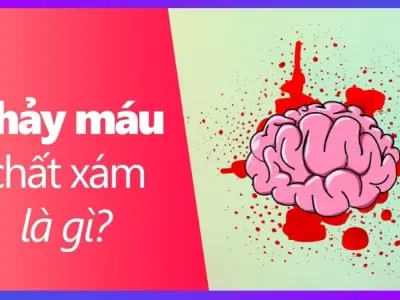 Chảy máu chất xám là gì? Mối lo trong thời hội nhập