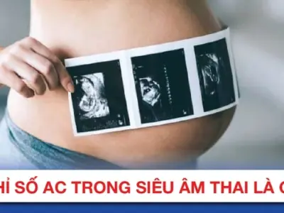 Chỉ số AC trong siêu âm thai là gì và có ý nghĩa ra sao