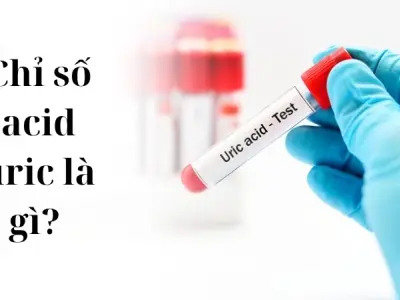Tìm hiểu chỉ số acid uric là gì và các mức độ nguy hiểm