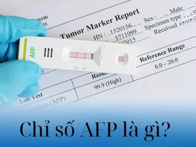 Tìm hiểu chỉ số AFP là gì và vai trò trong chẩn đoán y khoa