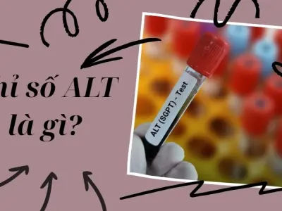 Chỉ số ALT là gì? Bao nhiêu là bình thường và nguy hiểm