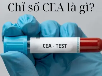 Xét nghiệm chỉ số CEA là gì và khi nào nên thực hiện