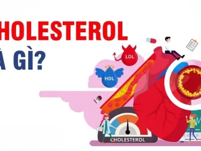 Chỉ số cholesterol là gì và ảnh hưởng đến sức khỏe ra sao