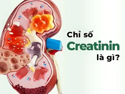 Chỉ số creatinin là gì và những điều ai cũng cần biết