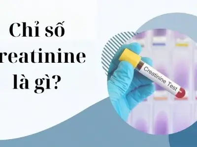 Tìm hiểu chi tiết chỉ số creatinine là gì trong xét nghiệm