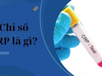 Chỉ số CRP là gì? khi nào cần làm xét nghiệm CRP
