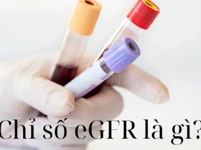 Chỉ số eGFR là gì? Cảnh báo sớm chức năng thận suy giảm