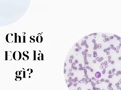 Chỉ số eos là gì? Những điều người bệnh cần hiểu rõ ngay