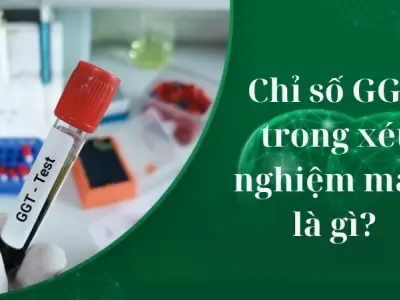 Chỉ số GGT trong xét nghiệm máu là gì và có ý nghĩa gì?