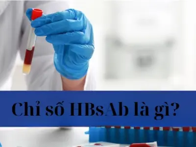 Chỉ số HBsAb là gì và có ý nghĩa xét nghiệm ra sao