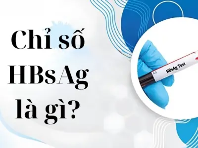 Chỉ số HBsAg là gì và có nguy hiểm cho sức khỏe không?