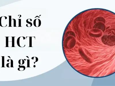 Chỉ số HCT là gì và tìm hiểu các mức độ bình thường