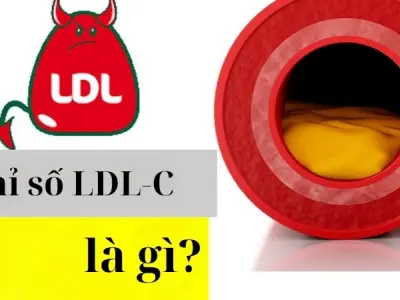 Chỉ số LDL-C là gì? Ảnh hưởng tới sức khỏe ra sao
