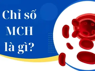 Chỉ số MCH là gì và ý nghĩa trong xét nghiệm máu
