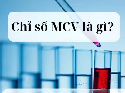 Giải mã chỉ số MCV là gì trong kết quả xét nghiệm máu