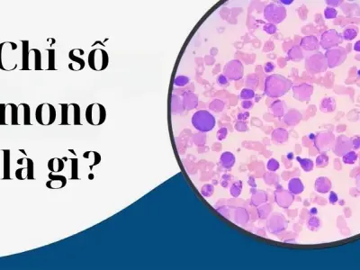 Chỉ số mono là gì và mức bao nhiêu là bình thường